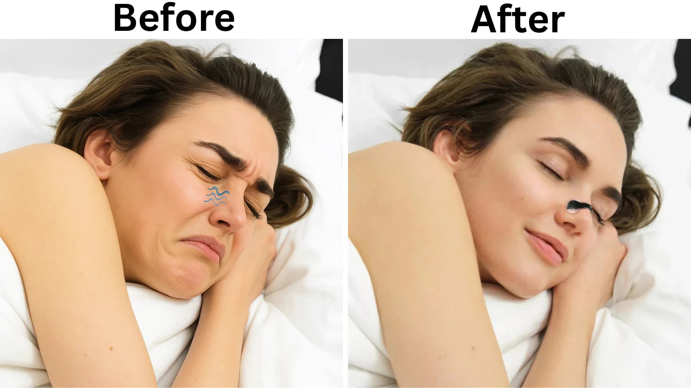 Breathing Nasal Strip Kit